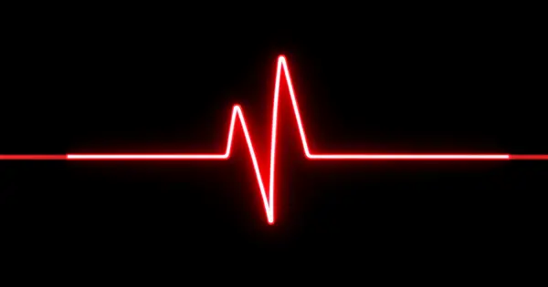 True Peak Limiting Mastering: 5 Things You Must Know